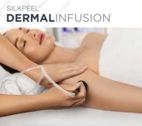 Dermalinfusion-treatment